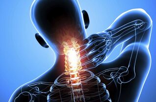 tratamentul osteocondrozei cervicale a coloanei vertebrale la domiciliu