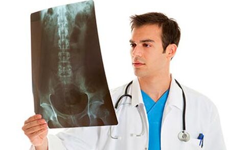 medicul se uită la o radiografie pentru a diagnostica durerea lombară